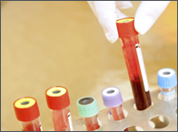 Clinique d'analyses sanguines privée